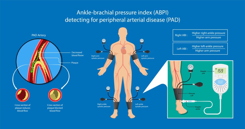 Circulation and Arterial Stiffness