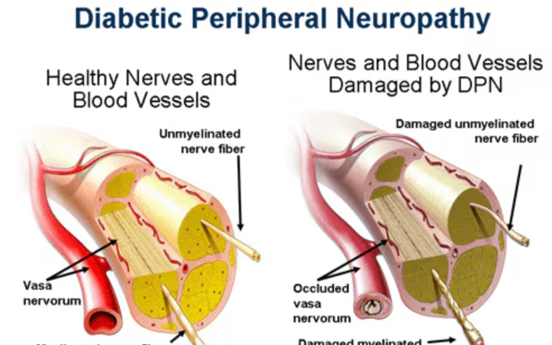 Early Detection of Nerve-Related Health, Diabetes and Metabolic Syndrome